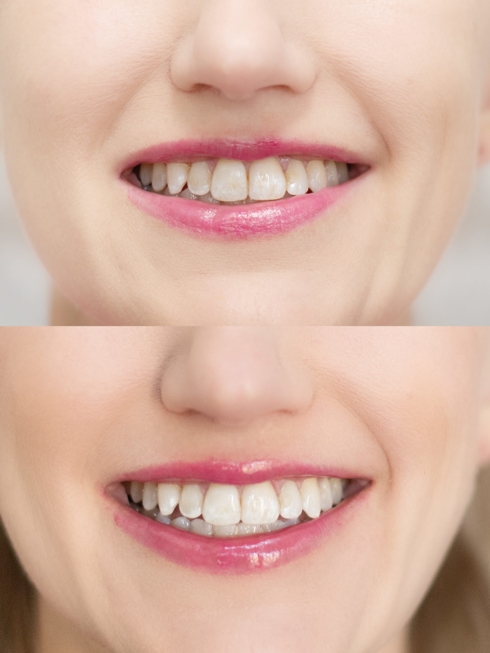 Michigan Petite Fashion and Lifestyle Blog | Smile Sciences Review