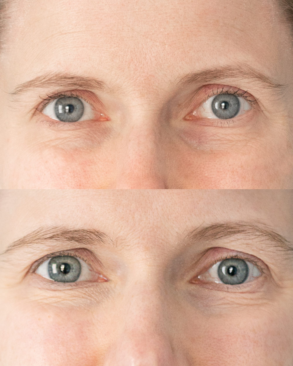 Petite Fashion Blog | Strivectin Anti Wrinkle Cream Before and After | Strivectin Anti-Wrinkle Cream Review